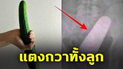 หมออึ้ง!! หนุ่มชายโคลอมเบีย ปวดท้องอย่างหนักเอกซเรย์ แตงกวาทั้งลูกอยู่ภายในช่องทวารหนัก