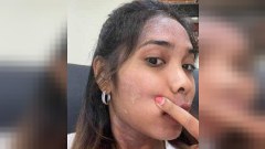 สาวติ๊กต๊อกเล่า "โรคเซ็บเดิร์ม" ขึ้นหน้า-คอ รุนแรงที่สุดในชีวิต ทำขาดความมั่นใจ