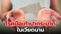 สาธารณสุขเตือน "โรคมือเท้าปากระบาดในเวียดนาม"