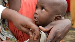 โรคหัดระบาดในไนจีเรีย ทำคนตายเกือบครึ่งร้อย