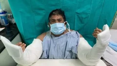 สะเทือนวงการแพทย์อินเดีย หลังชายแขนขาด2ข้างได้รับการต่อแขนใหม่แขนจากผู้บริจาคให้ จนสำเร็จ!!