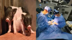 จีนประสบความสำเร็จในการผ่าตัดปลูกถ่ายตับจากสัตว์ไปยังมนุษย์เป็นครั้งแรก