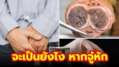 แค่เห็นก็จุกแล้ว! จะเป็นยังไงหากน้องชายคุณหัก…หมอเผย!