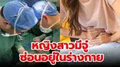 หญิงสาววัย 32 ปีจากจีนค้นพบว่าเธอมีอวัยวะเพศชายซ่อนอยู่ในร่างกาย พร้อมกับเนื้องอกขนาดใหญ่ถึง 20 เซนติเมตร!