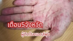 เตือน! 5จังหวัดโรคเอดส์พุ่ง