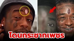 แร็ปเปอร์หนุ่ม ฝังเพชรไว้ที่กลางหน้าผาก ก่อนจะโดนแฟนคลับกระชากออก