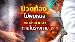 เด็กหญิงปวดท้องไปพบแพทย์ แพทย์พบสิ่งน่ากลัวภายในร่างกาย