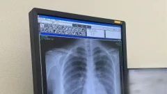 "ปอดสะอาดแต่ใจว้าวุ่น!" โทโยชิมะ โคโคโระ โชว์ฟิล์ม X-ray ยืนยันความตู้ม H-Cup ของแท้แม่ให้มา