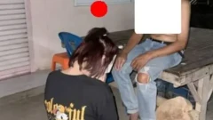 เตือนภัยการรักษา "งูสวัด" ด้วยการเป่ามนต์และพ่นสมุนไพร