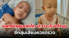 แพทย์เผยเคสเด็ก ป.3 มะเร็งเต้านม ชี้กลุ่มเสี่ยงควรตรวจ