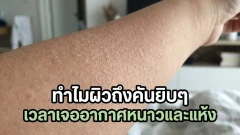 ทำไมผิวถึงคันยิบๆ เวลาเจออากาศหนาวและแห้ง