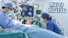 ผ่าตัดสมองขณะตื่นได้อย่างไร