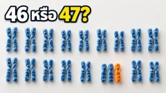 คนทั่วไปมี 46 โครโมโซม แล้วดาวน์ซินโดรมมี 47 ทุกคนไหม?
