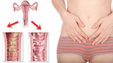 อันตราย จากอาการ 'ตกขาว' ที่สาวๆ ควรระวัง