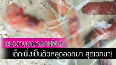 แรงงานพม่าตกเลือด ส่งรพ.ไม่ทัน เด็กเพิ่งเป็นตัวหลุดออกมา น่าสางสารมาก