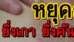 วิธีหยุด สังคัง ยิ่งเกา ยิ่งคัน ยิ่งลามไปเรื่อย
