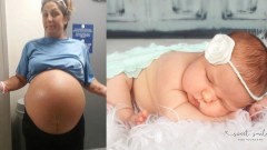 สาวท้องโตมาก คิดว่าได้ลูกแฝด พอถึงวันคลอด กลับเจอความน่ารักแบบนี้