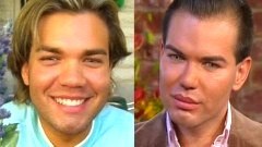 เผยภาพในอดีตของ Rodrigo Alves หรือที่รู้จักกันในฉายา Human Ken Doll ก่อนทำศัลยกรรมร่างกาย