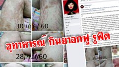 อุทธาหรณ์!! กินยาอกฟูรูฟิตตลาดนัด แค่กล่องเดียว ร่างพังพินาศ