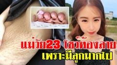 คุณแม่วัย 23 โพสต์ภาพเผยหน้าท้องลายเกินเยียวยา บอกเป็นความผิดเธอเอง เพราะมีลูกมากไป!