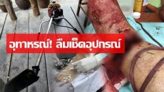 อุทาหรณ์! ลืมเช็คอุปกรณ์ เครื่องตัดหญ้า “ตัดขาขาด” เป็นภาพที่สยองมาก…