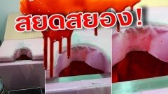 สยดสยอง เมื่อไปตรวจใช้สิทธิประกันสังคม ณ โรงพยาบาลแห่งหนึ่ง