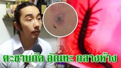 ตะขาบกัด "อัณฑะ" กลางห้างไม่ใช่เรื่องเล็ก! อาจารย์มหาวิทยาลัย เผยภาพสุดทรมาน วอนห้างดังรับผิดชอบ