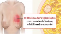 10 วิธีตรวจเต้านมด้วยตนเอง คลำหาง่ายๆด้วยสองมือเรา ทำไว้เถอะดีรู้ก่อนรักษาทัน