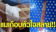 เตือนภัยใกล้ตัว หนูน้อยนั่งกินไอศกรีม พลัดตกเก้าอี้ไม้เสียบปาก เสี้ยววินาทีก็อันตราย