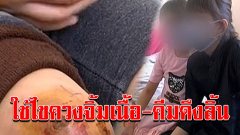 จับแม่เลี้ยงสาว ทำร้ายลูกติดสามี ใช้ไขควงจิ้มเนื้อ คีมดึงลิ้น