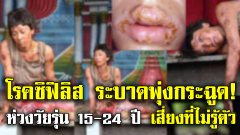 โรคซิฟิลิส ระบาดพุ่งกระฉูด!! ห่วงวัยรุ่นอายุ 15-24 ปี กลุ่มเสี่ยงที่ไม่รู้ตัว
