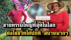 ทั่วโลกยอมรับ ชายที่มี น้องชายใหญ่ที่สุดในโลก 18.9 นิ้ว แต่ใช้ชีวิตได้ปกติ