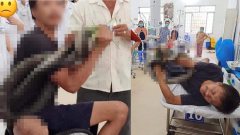 สุดระทึก ชายถูกงูจงอางกัด เลยพกงูมาให้หมอดูตัวเป็นๆ จะได้แก้พิษได้ถูกชนิด