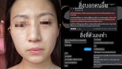ฉาวอีกสตรีมเมอร์ซ้อมแฟนเจ็บสาหัส ขอโทษผ่านเพจ แต่แอบไปเยาะเย้ยกับเพื่อนลับหลัง