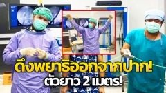 ตะลึง!! สายกินดิบมีเสียว พบพยาธิตัวตืดยาวกว่า 2 เมตร ในท่อน้ำดี เหตุกินของดิบ!!