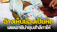 รุ่นพี่หวังดี อ้างเห็นน้องเป็นหิด เลยเอาซีม่าชุบสำลีทาให้