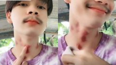 ชาวเน็ตด่ายับ หนุ่มสุดภูมิใจ โชว์รอยดูดเต็มคอ (คลิป)