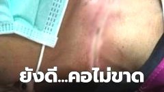 หนุ่มขับมอไซค์กลับบ้าน โดนสายอะไรไม่รู้ คอเกือบขาด!!