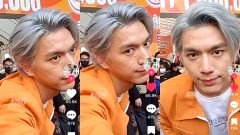 ชาวเน็ตสงสัย หนุ่มคนดัง ผิวหน้าเป็นแบบนี้จริงๆเหรอ?