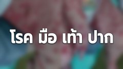 เพจดังเตือนภัย!! โรคมือเท้าปาก +กับอาการแทรกซ้อนภูมิแพ้ ผื่นเลยขึ้นทั้งตัว