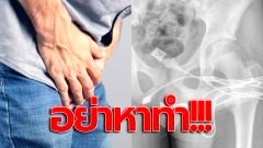 หัวจะปวด! หนุ่มวัย 15 ปี ถูกหามส่งรพ.ด่วน หลังข้องใจความยาวอวัยวะเพศของตัวเอง