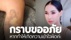 "บาสตี้" โพสต์ชี้แจง กรณีที่ตนเองอ้าง ว่าอยู่ในเหตุการณ์ ที่ "อิแทวอน" แล้วก๊อบปี้ "รูปขาที่มีรอยช้ำ" จากเว็บต่างชาติ