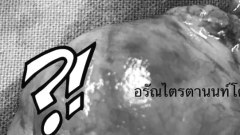 ฝากเตือน..!! “ภัยจากการใช้ยาคุมฉุกเฉิน”