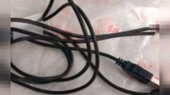 หนุ่มอังกฤษคะนอง! "ยัดสาย USB ทั้งเส้น" เข้าไปในหรรม สุดท้ายดึงออกไม่ได้ เจ้าตัวเผย แค่อยากวัดขนาด