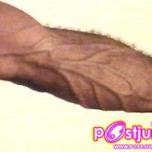 เส้นเลือด!!!!!