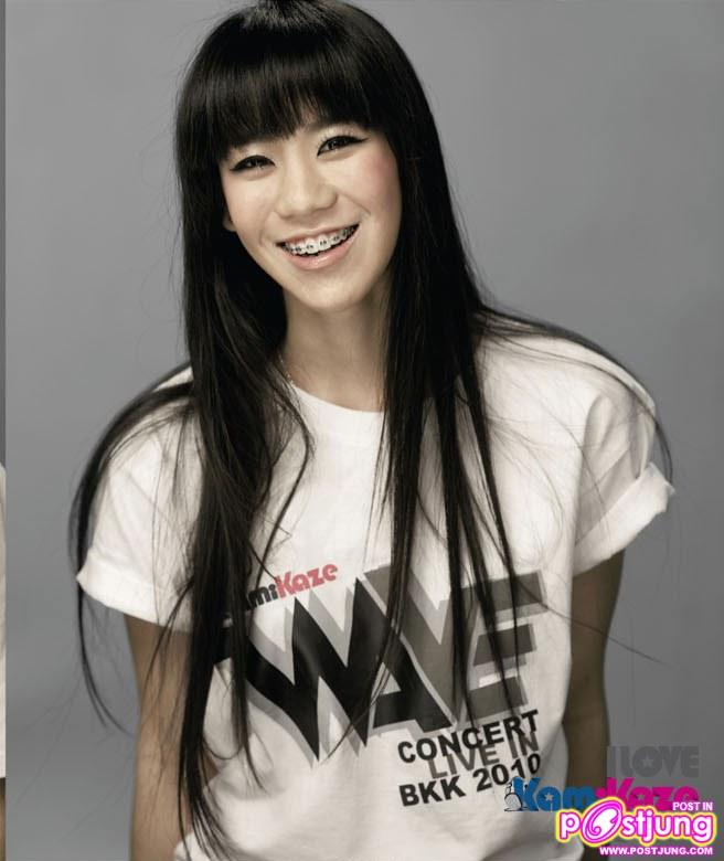 เริ่มดัดฟันแล้ว