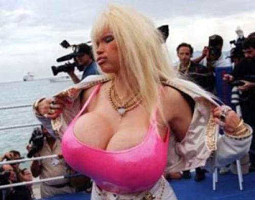 พิษร้าย ศัลยกรรม !!