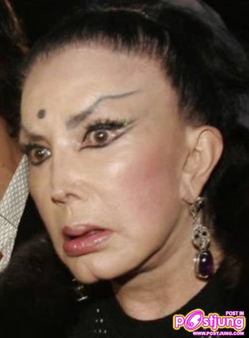 พิษร้าย ศัลยกรรม !!