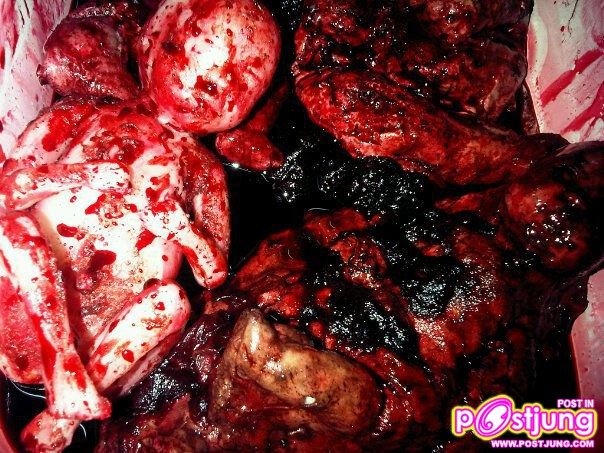 ศพเด็ก 2002