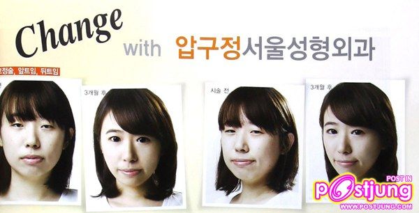 คนเกาหลี หน้าตาดีที่สุด ?? ใช่เหรอ ??